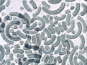 poudre de spiruline au microscope: crédit Wikipedia
