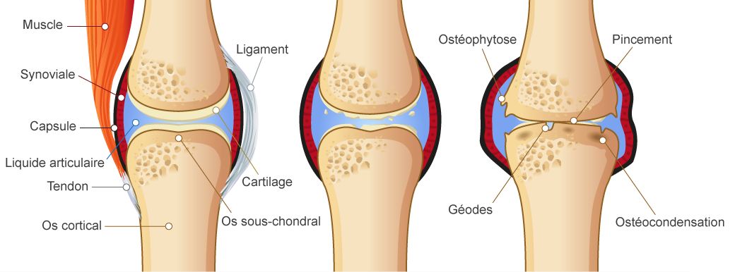 https://public.larhumatologie.fr